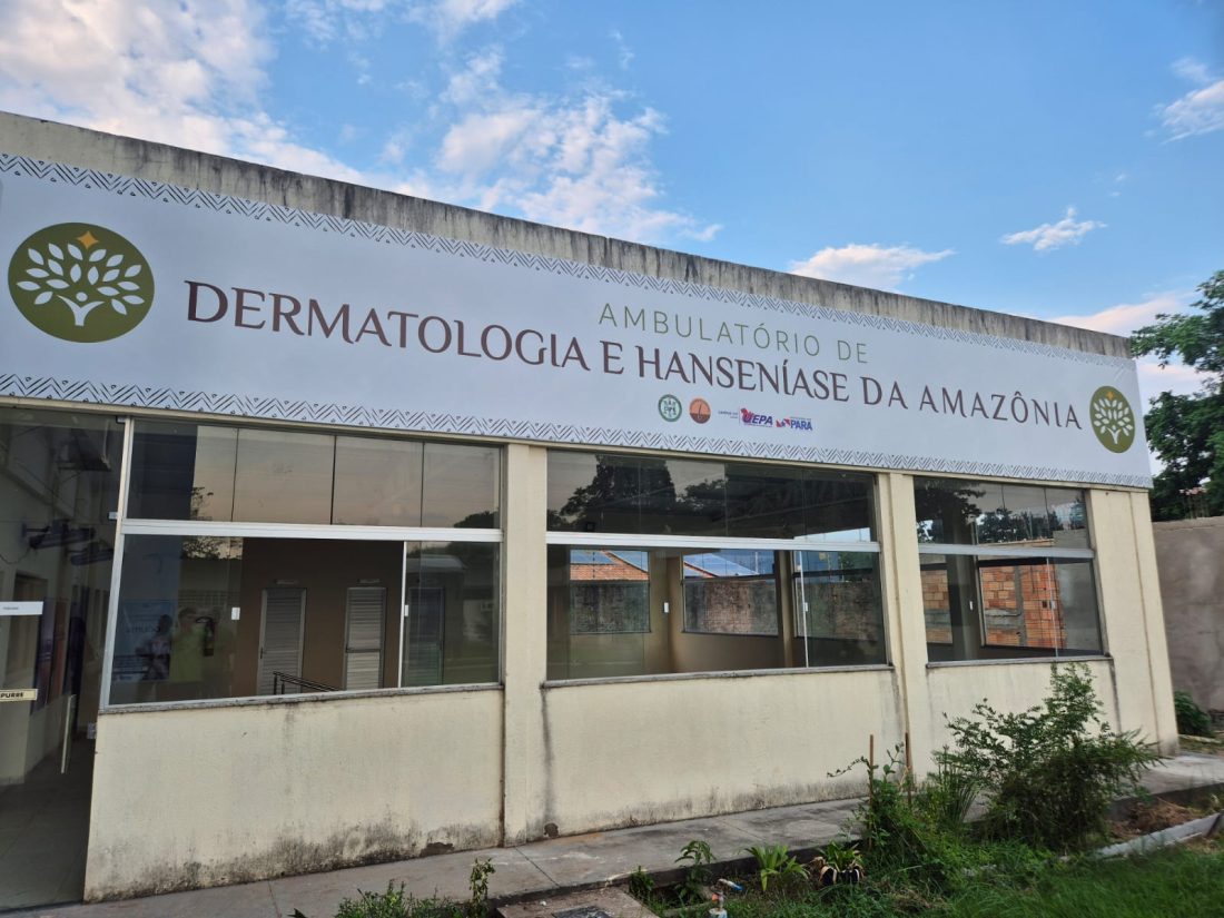 Saúde: Marabá ganha Ambulatório de Dermatologia e Hanseníase da Amazônia